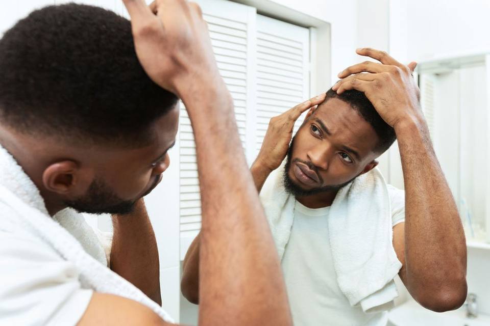 Scalp Micropigmentation for Men in Atlanta – Permanent Makeup of Atlanta: smp men img1