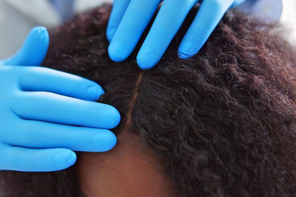 Scalp Micropigmentation for Women in Atlanta – Permanent Makeup of Atlanta: smp woman
